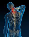 neck pain treatment vancouver physio