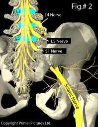 sciatica pain treatment vancouver bc